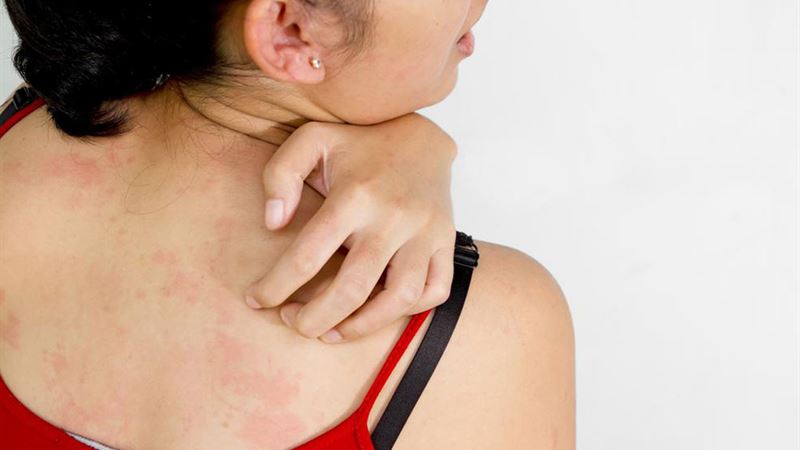 Understanding Common Causes of Itchy Skin and How to Address Them