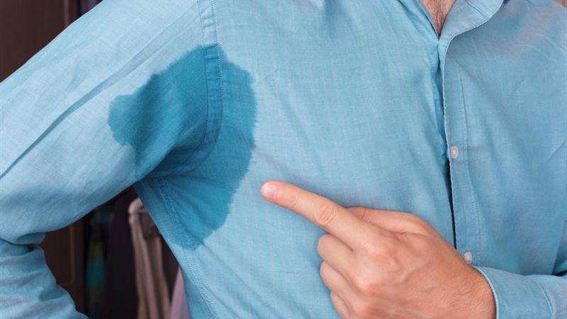 Effective Strategies for Managing Excessive Sweating (Hyperhidrosis)