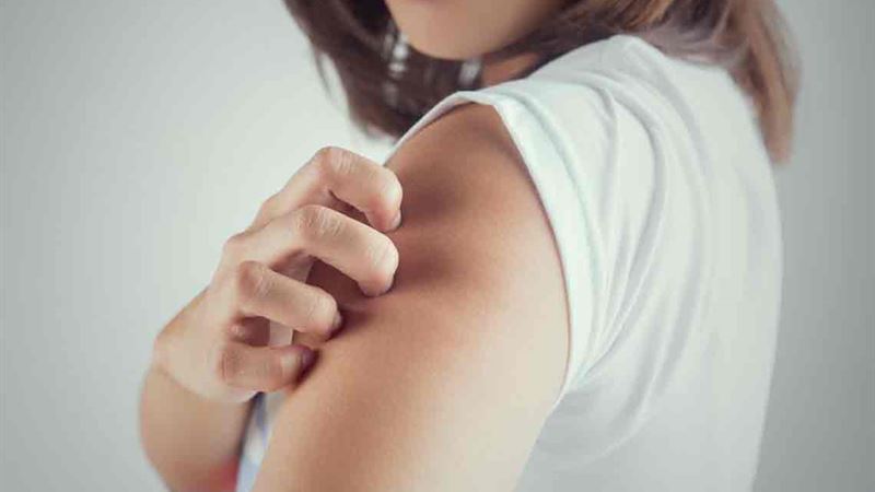 Comprehensive Guide to Understanding and Managing Itchy Skin