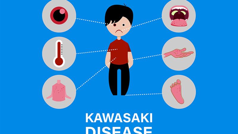 Understanding Kawasaki Disease: Causes, Signs, and Treatment Approaches