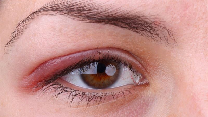 Comprehensive Guide to Protecting and Maintaining Healthy Eyes