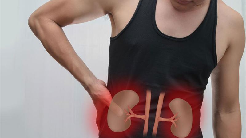 Understanding Kidney Failure: Causes, Symptoms, and Prevention Strategies