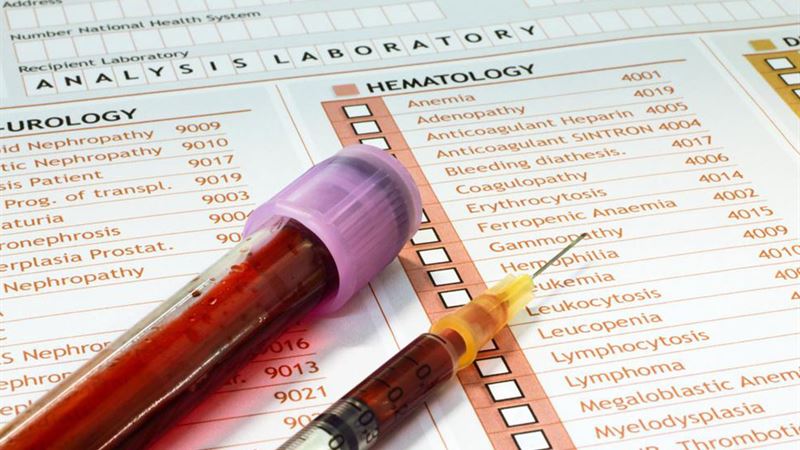 Understanding Premature Ejaculation: Causes, Symptoms, and Effective Treatments