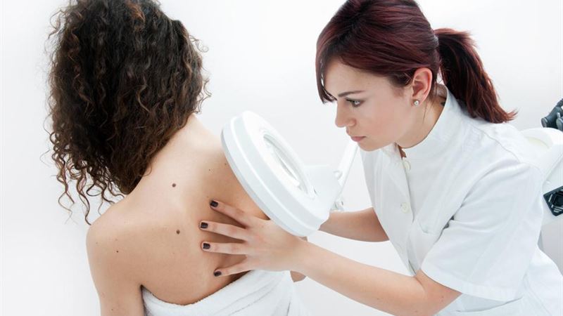 Comprehensive Guide to Stage Four Melanoma: Symptoms, Diagnosis, and Treatment Options