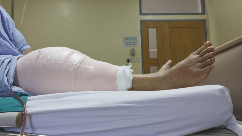 Complete Guide to Knee Replacement Surgery: What You Should Know