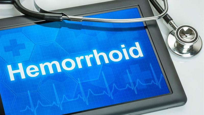 Understanding Hemorrhoids: Causes, Symptoms, and Prevention Strategies