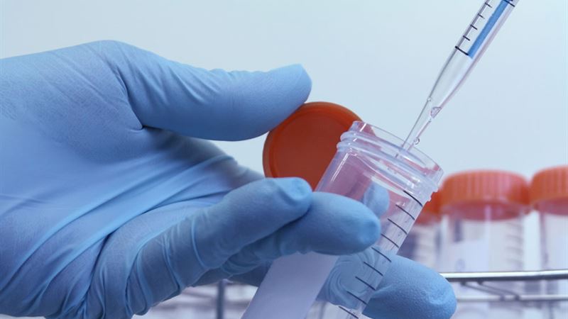 Comprehensive Guide to Helicobacter Pylori Infection: Symptoms, Causes, Risks, and Treatments