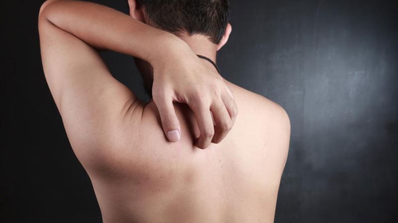 Comprehensive Guide to Recognizing and Managing Skin Rashes with Visual Aids