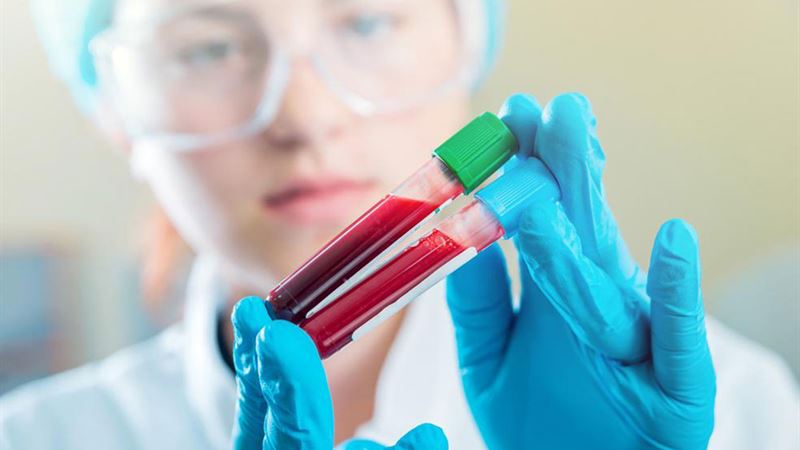 Understanding the Importance of Maintaining Healthy Creatinine Levels for Kidney Wellness