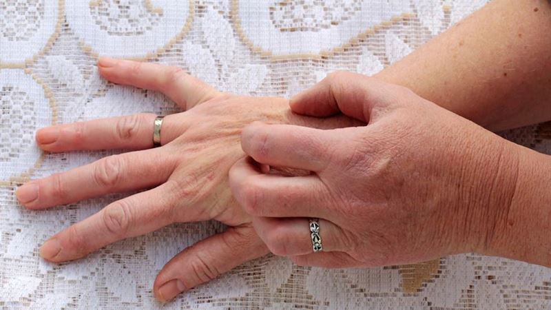 Top 5 Effective Allergy Relief Medications for Instant Comfort