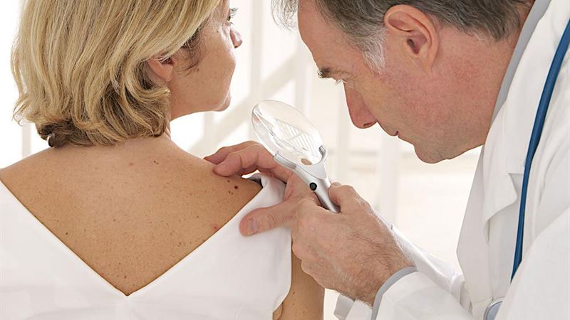 Comprehensive Guide to Recognizing, Understanding, and Managing Atopic Dermatitis