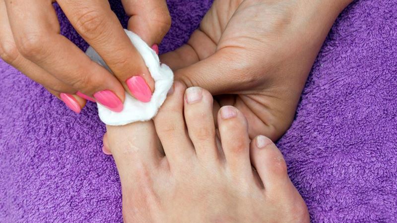 Effective Strategies for Treating Nail Fungus and Promoting Healthy Nails