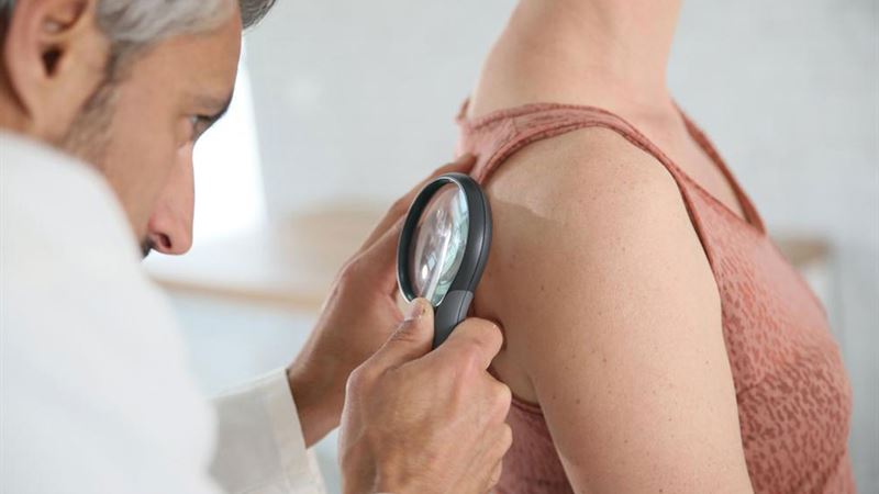 Effective Strategies and Treatments for Managing and Overcoming Shingles