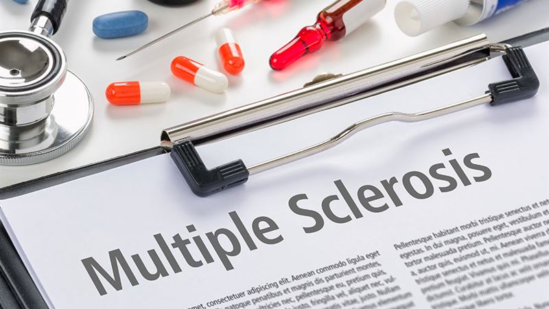 Understanding Multiple Sclerosis: Stages, Diagnosis, and Preventive Insights