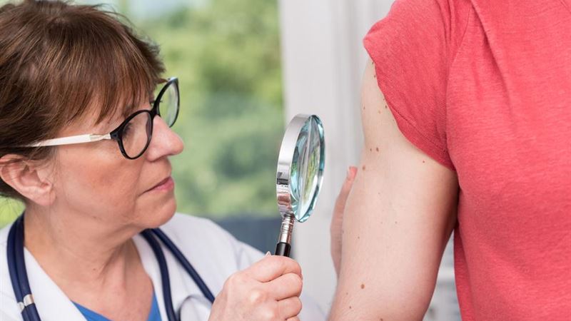 Comprehensive Guide to Eczema Types, Symptoms, and Effective Treatment Options