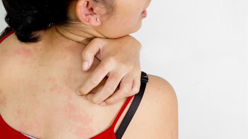 Effective Strategies and Treatments for Vaginal Yeast Infections