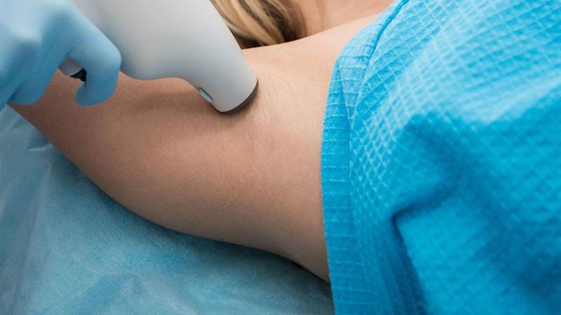 Comprehensive Guide to Effective Treatments for Excessive Sweating