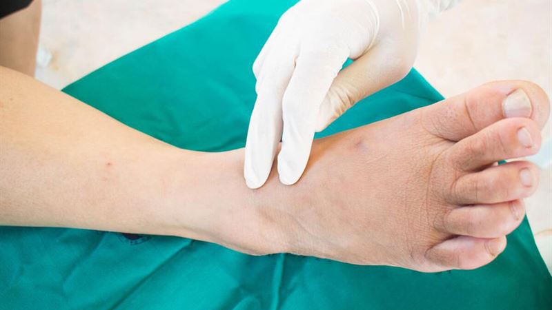 Effective Strategies for Managing Diabetes-Related Foot Issues