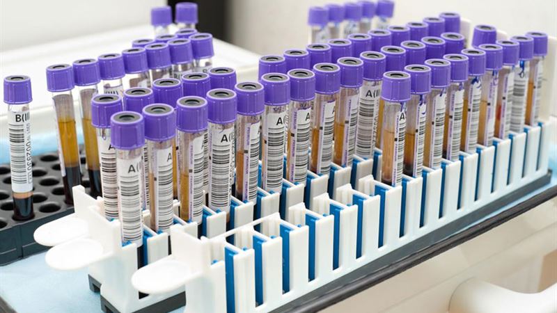 Comprehensive Guide to Age-Based PSA Levels and Prostate Cancer Detection