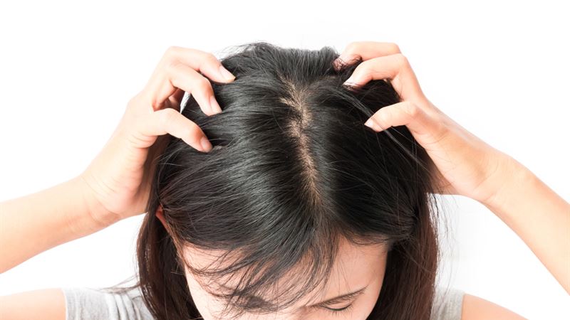 Comprehensive Guide to Managing an Itchy Scalp Effectively