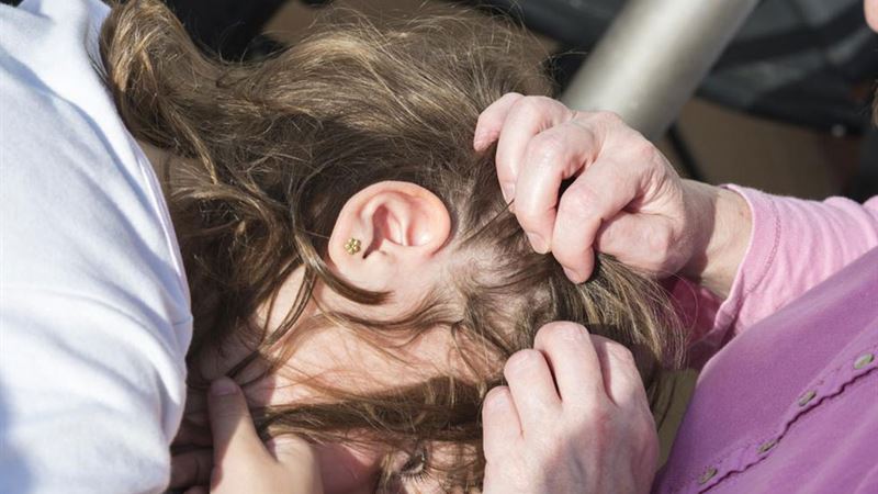 Effective Home Remedies to Eliminate Head Lice Naturally