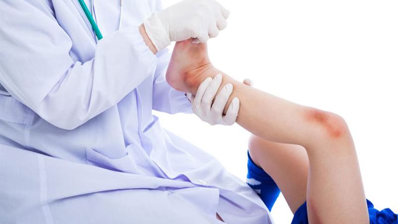 Effective Strategies for Accelerating Bruise Recovery Naturally and Medically