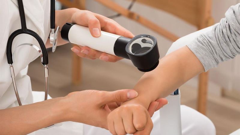 Comprehensive Guide to Understanding Psoriasis: Risk Factors and Symptoms