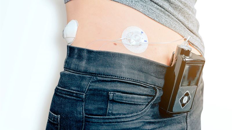Top 3 Insulin Delivery Devices for Diabetes Management in 2024