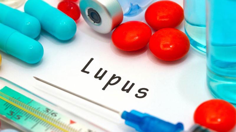 Comprehensive Strategies and Natural Remedies for Managing Lupus