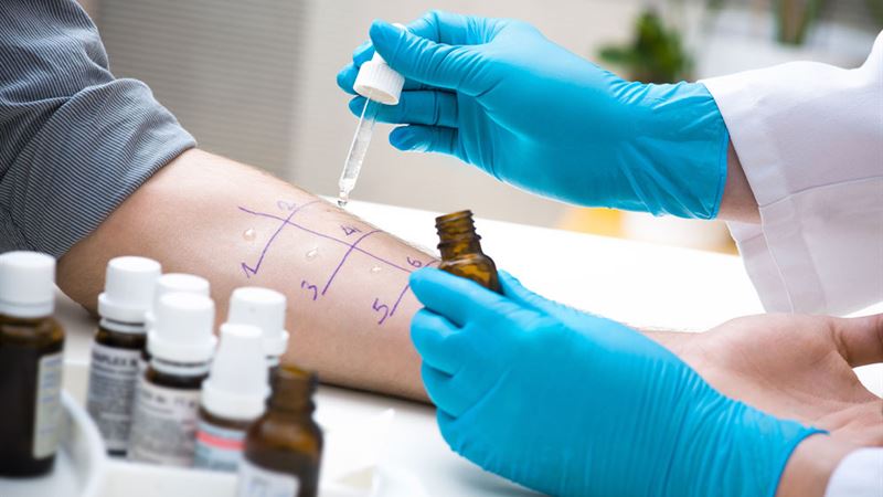 Comprehensive Guide to Detecting Gluten Sensitivity: Symptoms, Testing Methods, and Health Benefits