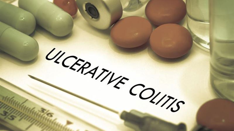 Comprehensive Guide to Effective Ulcerative Colitis Treatments and Management Strategies