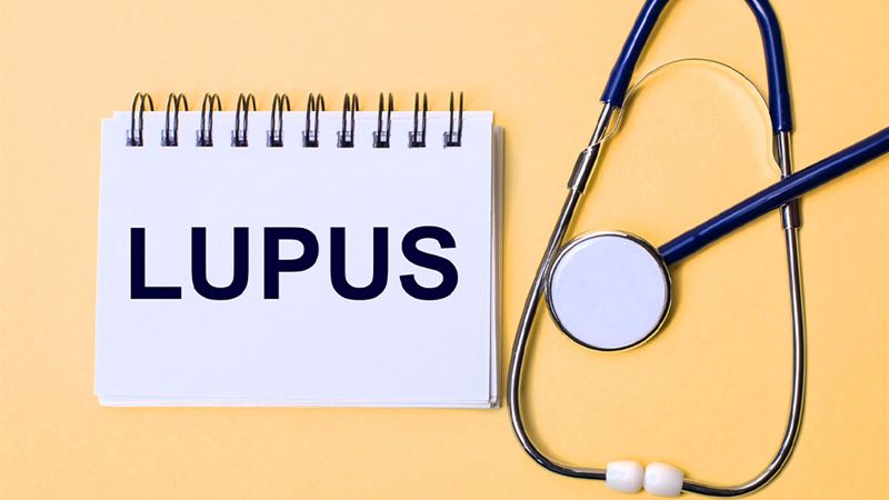Understanding Lupus: Symptoms, Causes, and Types Explained