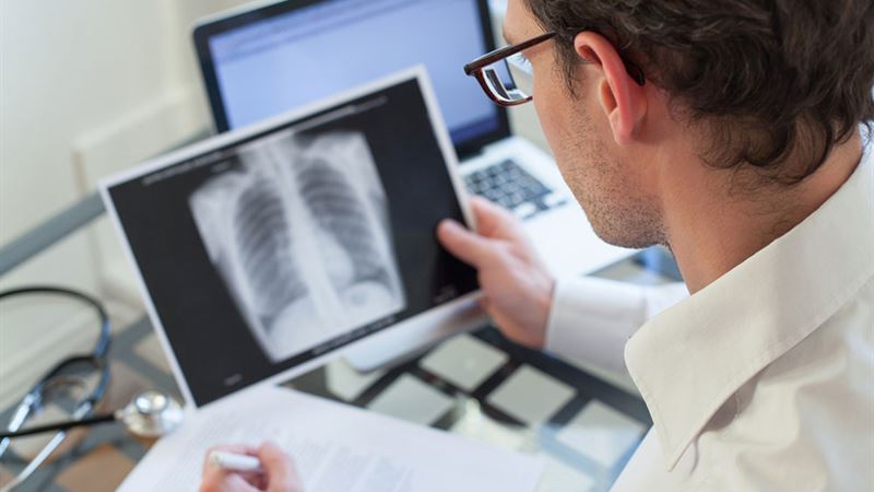 Understanding Pneumonia: Symptoms, Causes, Risk Factors, and Diagnostic Methods