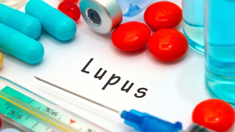 Comprehensive Guide to Managing Lupus: Essential Procedures and Treatments