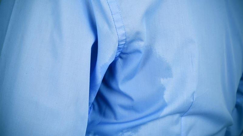 Comprehensive Overview of Causes and Management of Excessive Sweating