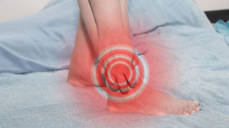 Comprehensive Guide to Effective Strategies for Managing Gout Pain