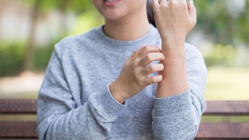 Comprehensive Strategies for Early-Stage Melanoma Treatment and Management