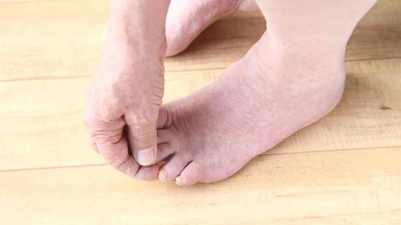 Comprehensive Exploration of Common Causes of Foot Discomfort and Pain