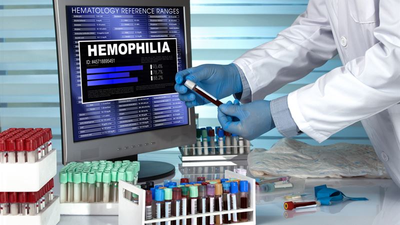 Comprehensive Overview of Hemophilia Types: A Deep Dive into Hemophilia A and Hemophilia B