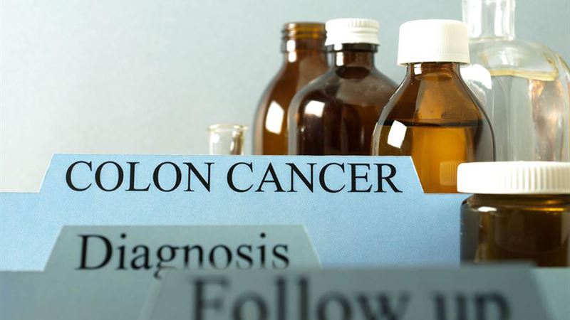 Comprehensive Guide on Colon Cancer: Prevention, Treatment, and Resources