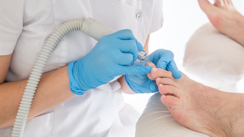 Comprehensive Guide to Effectively Treating Nail Fungus