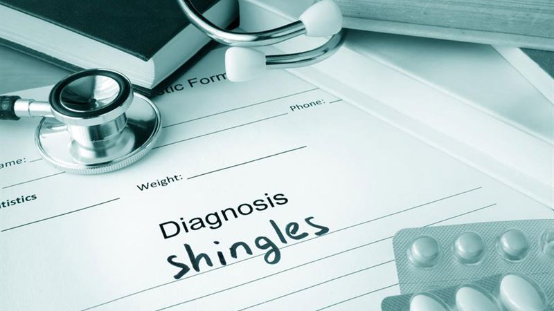Comprehensive Natural Strategies for Managing Shingles Symptoms