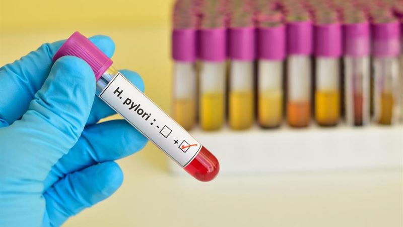 Comprehensive Guide to H. Pylori Infection: Causes, Symptoms, Diagnosis, and Prevention