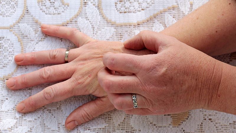 Comprehensive Guide to Managing and Treating Scabies: Symptoms, Causes, and Preventive Measures