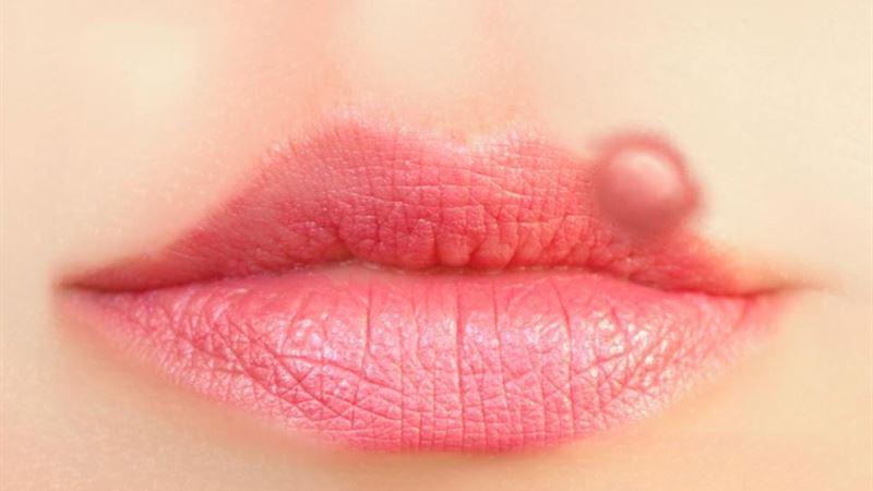 Effective Strategies for Rapid Cold Sore Relief and Prevention