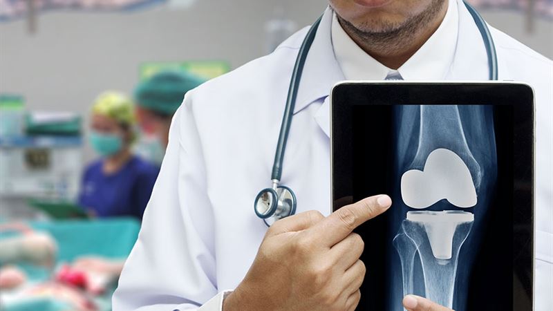 Comprehensive Guide to Understanding and Managing Knee Replacement Surgery