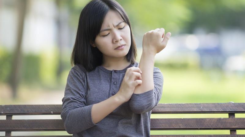 Comprehensive Guide to Managing Psoriasis and Living Well with the Condition