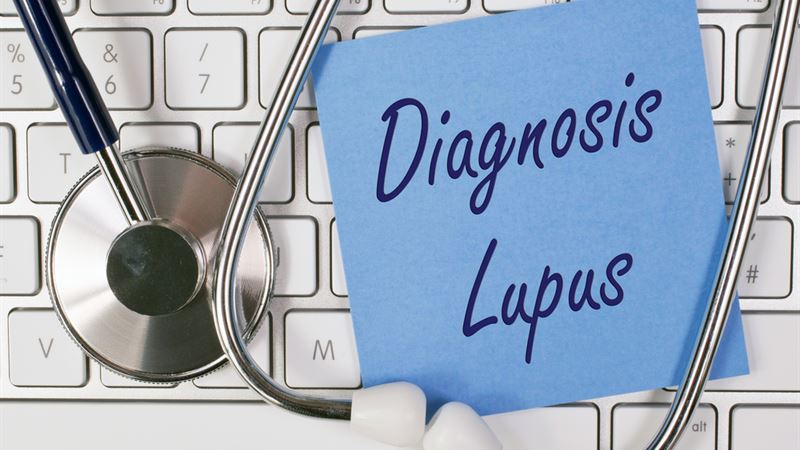 Comprehensive Guide to Diagnosing Lupus: Methods and Tests Explained