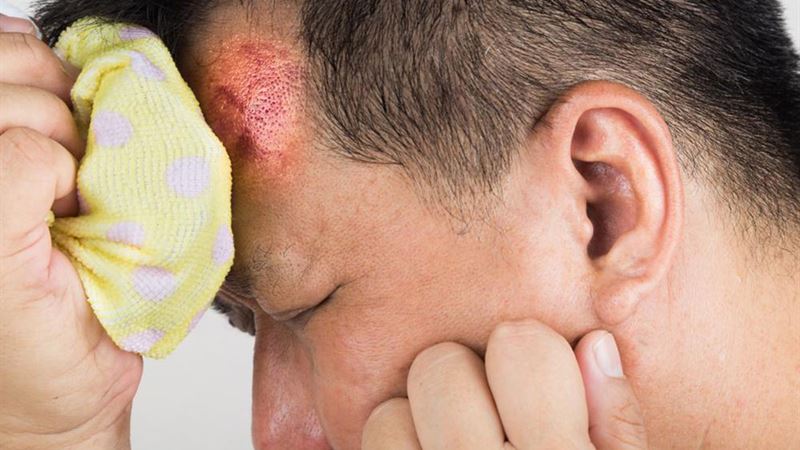 Recognizing and Preventing Concussions: Essential Signs and Safety Measures