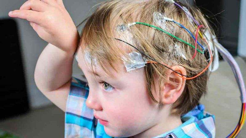 Comprehensive Guide to Managing Seizures: Treatment Strategies and Prevention